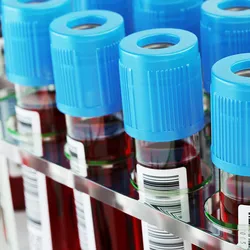 Photo of blood samples in test tubes with blue caps in a clinical laboratory awaiting testing for Alzheimer's disease with VeraBIND™ Tau.
