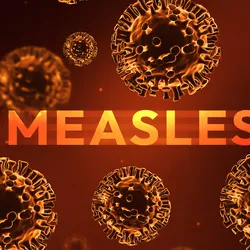 Illustration of the measles virus particles with the word 'measles' in bold against an orange background.