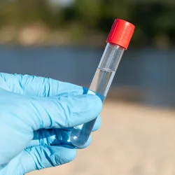 Photo of a laboratory scientist's gloved hand holding up a water sample from a river to be tested for antibiotics.