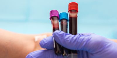 Photo of a gloved hand holding up three test tubes with human blood samples in them in a clinical laboratory.