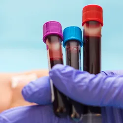 Photo of a gloved hand holding up three test tubes with human blood samples in them in a clinical laboratory.