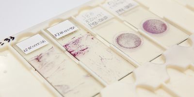 This breakthrough is anticipated to pave the way for next-generation non-invasive pathological diagnosis.