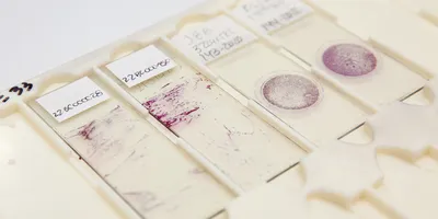 This breakthrough is anticipated to pave the way for next-generation non-invasive pathological diagnosis.