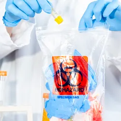 Failure to comply with local waste regulations can lead to serious consequences, including fines, reputational damage, and even threats to public health and the environment. 