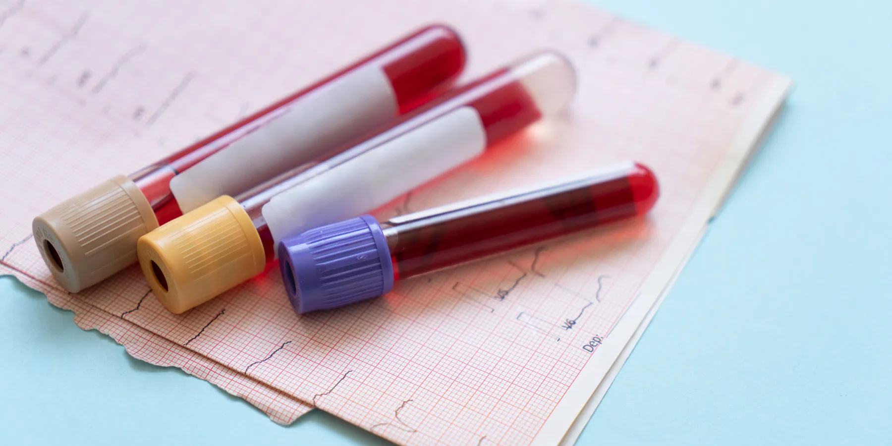 A critical challenge in treating, researching, and living with multiple sclerosis is that MRI and neurological exams identify disease changes only after they have occurred.