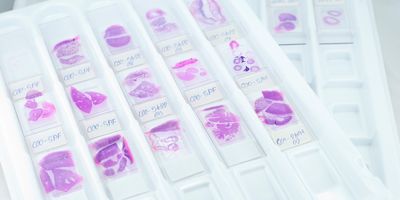 The study included 98 pathologists and researchers from other professions.