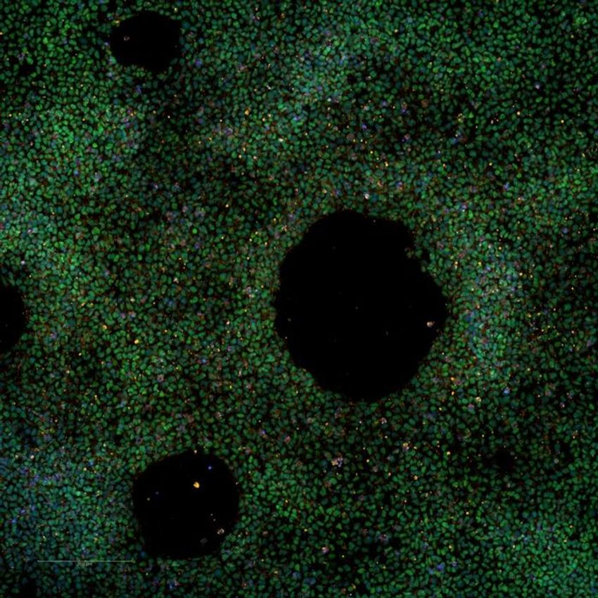 iPSC differentiated to mesoderm showing expression of mesoderm markers Brachyury (green) and CXCR4 (orange). iPSC differentiated to mesoderm showing expression of mesoderm markers Brachyury (green) and CXCR4 (orange).