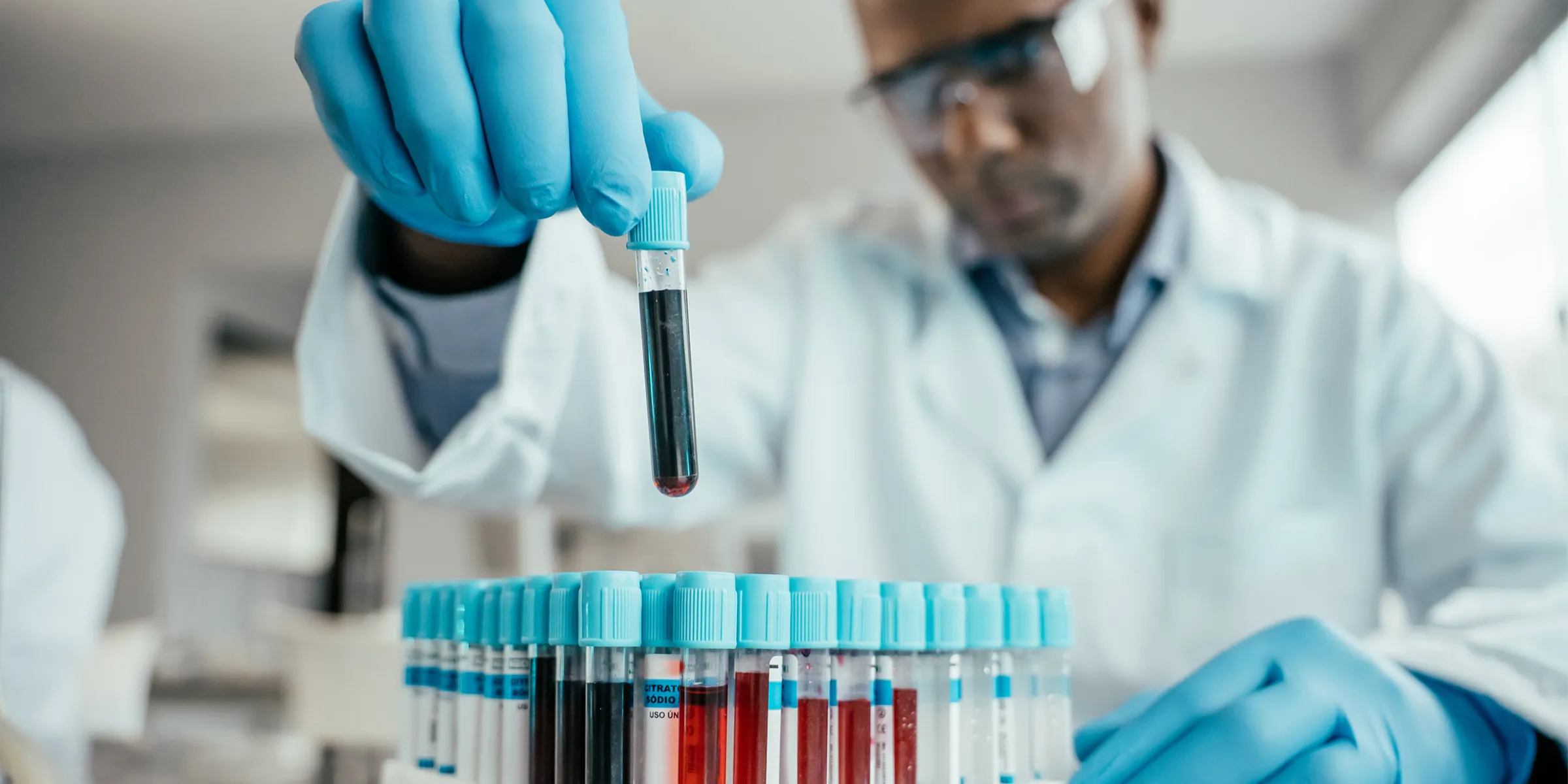 82313-2400x1200 Scientist holding blood collection tube for analysis