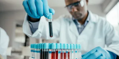 Scientist holding blood collection tube for analysis
