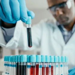 Scientist holding blood collection tube for analysis