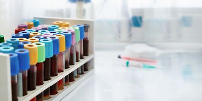 Caris built on the findings from the study and analyzed 3,255 matched tumor–blood NGS samples from its extensive real-world clinico-genomic database of over 500,000 samples.