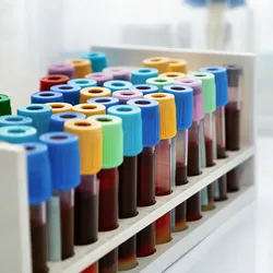 Caris built on the findings from the study and analyzed 3,255 matched tumor–blood NGS samples from its extensive real-world clinico-genomic database of over 500,000 samples.