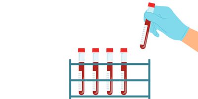 There are 6.5 million women living with endometriosis in the United States, yet it is still notoriously difficult to diagnose, with a definitive diagnosis taking an average of seven years. 