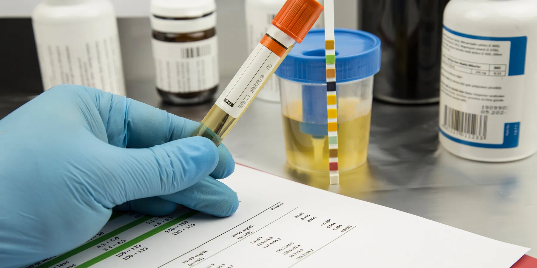 Researchers have long known that standard urine drug screening can sometimes trigger false positives, or erroneous results that indicate the presence of a drug when there isn’t one.