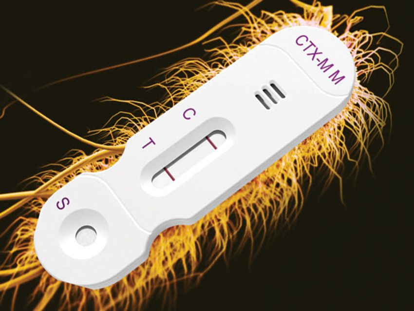 The rapid and widespread emergence of extended-spectrum beta-lactamases (ESBLs) is a growing global health concern.