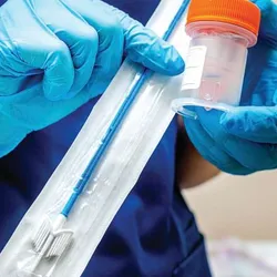 Cervical cancer is one of the most preventable cancers.