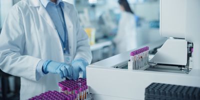 MosaiQ AiPlex® Vasculitis assay, now available for clinical use in the European Union and other CE mark accepting countries.