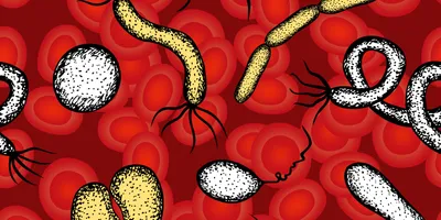 Despite the alarming statistics, many sepsis-related deaths are preventable through rapid diagnosis and treatment.