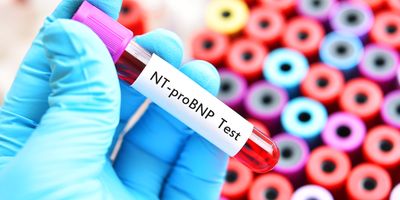 Increased cardiometabolic testing for adults with diabetes, and all adults in the case of Lp(a), will translate to many millions of additional laboratory tests across the US in the coming years.