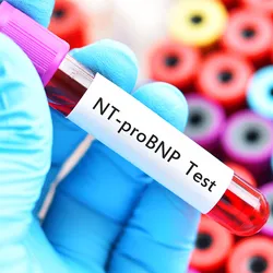 Increased cardiometabolic testing for adults with diabetes, and all adults in the case of Lp(a), will translate to many millions of additional laboratory tests across the US in the coming years.