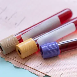 Elevated levels of lipoprotein(a) are strongly linked to a higher risk of heart attack, stroke, and aortic valve disease.