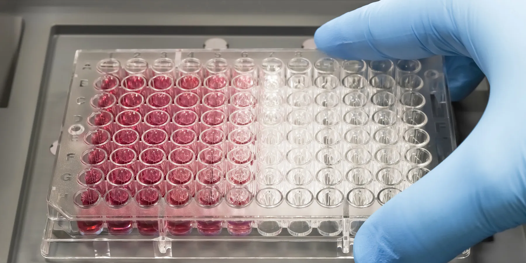 15-000-women-a-year-with-breast-cancer-could-benefit-from-whole-genome-sequencing-say-researchers7 In 2022, 2.3 million women were diagnosed with breast cancer worldwide and there were 670,000 related deaths.