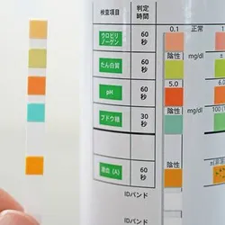 Kobe University ISHIMORI Shingo and his team found that the most common reason why patients were referred to hospital for testing for Alport syndrome was due to age-3 urine screening results. In addition, 60% of these people already met the conditions for treatment.
