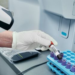 Rethinking Your Sample Management System