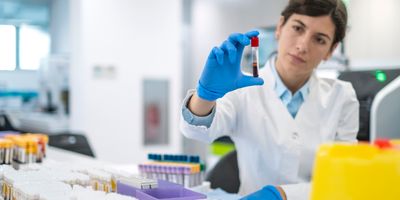 Scientist examining a blood sample in a laboratory focused on sample management processes