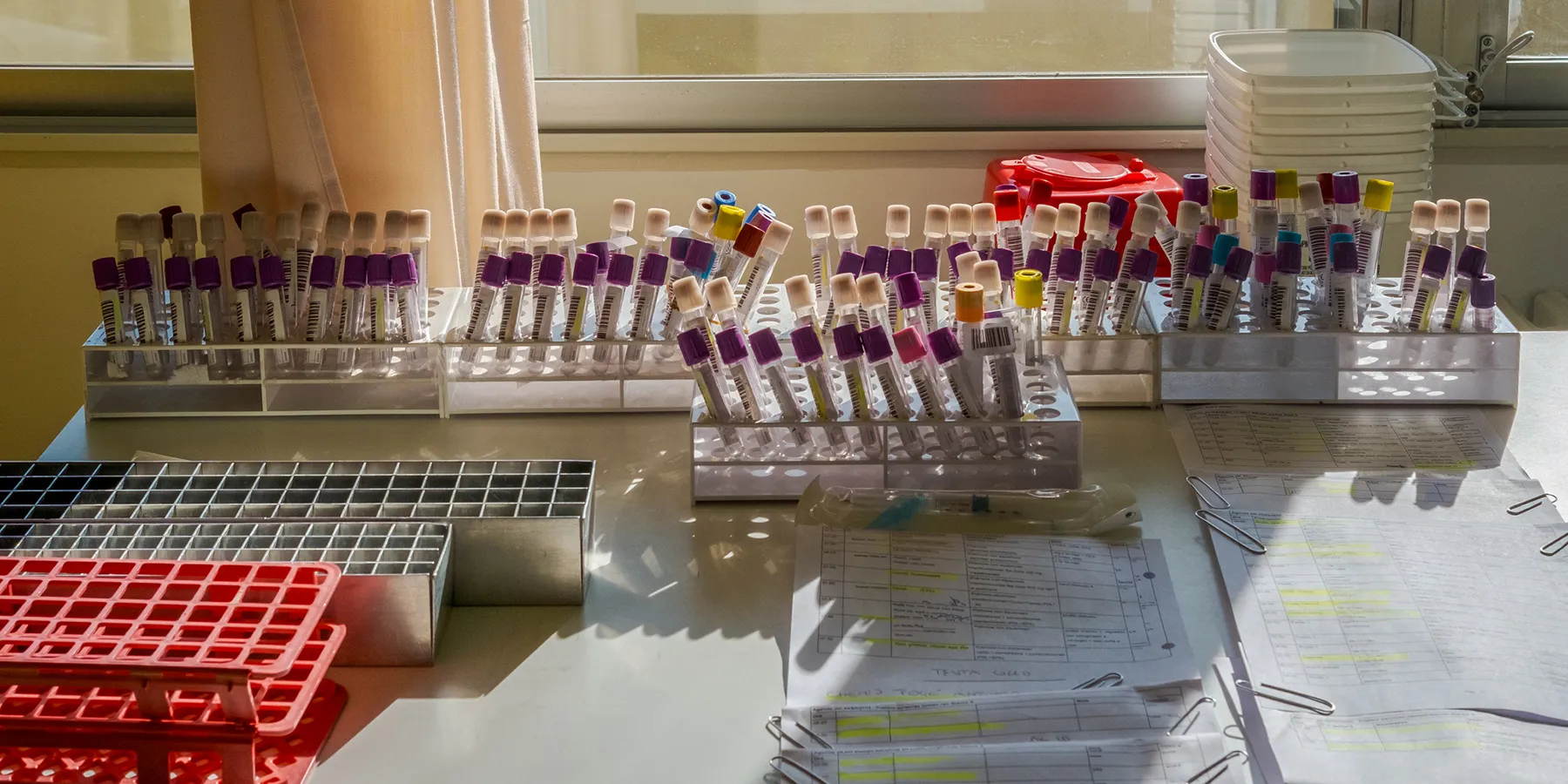 biomarker-can-help-predict-preeclampsia-risk-in-women-with-sickle-cell-disease Sickle cell disease is the most common inherited blood disorder and is marked by abnormally shaped red blood cells that can block blood vessels, leading to pain and infection.