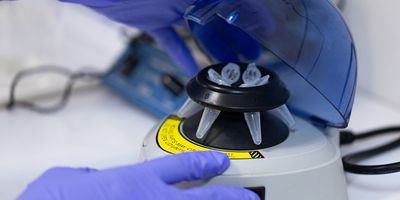 This milestone not only sets a GUINNESS WORLD RECORDS™ for the fastest human whole genome sequencing to date but represents a significant clinical development that would expedite more precise treatments to critically ill babies in the NICU. 