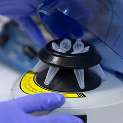 This milestone not only sets a GUINNESS WORLD RECORDS™ for the fastest human whole genome sequencing to date but represents a significant clinical development that would expedite more precise treatments to critically ill babies in the NICU. 