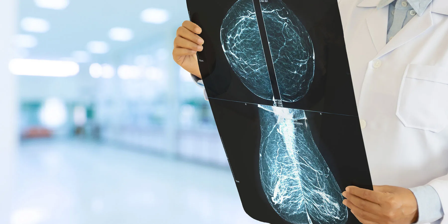 new-antibody-restricts-the-growth-of-aggressive-and-treatment-resistant-breast-cancers While researchers have been modifying antibodies to boost their ability to activate immune cells, highly effective ones to be used for the treatment of breast cancer are still needed.