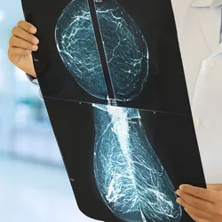 While researchers have been modifying antibodies to boost their ability to activate immune cells, highly effective ones to be used for the treatment of breast cancer are still needed.