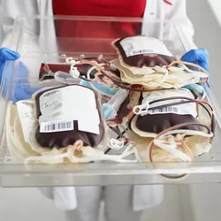 Having effective conservation strategies, like patient blood management, always helps stabilize and improve patient care.