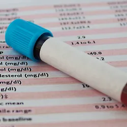 Direct oral anticoagulants (DOACs) are one of the most common types of blood thinners.