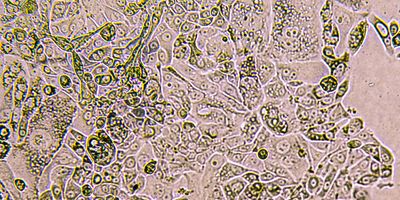 These lab-grown models replicate the environment inside the human body and could unlock clues about how cancer begins.