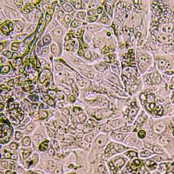 These lab-grown models replicate the environment inside the human body and could unlock clues about how cancer begins.