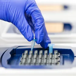 The study adds new evidence that brain-related biomarkers might play a useful role in monitoring recovery and guiding personalized care for young patients with concussion.