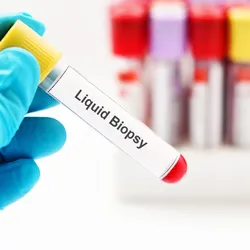 Researchers are now targeting clonal hematopoiesis and building new solutions to help make liquid biopsy a frontline defense in the fight against cancer.