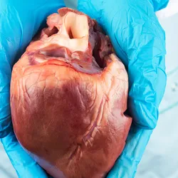 About 800,000 people have a heart attack every year in the US alone.