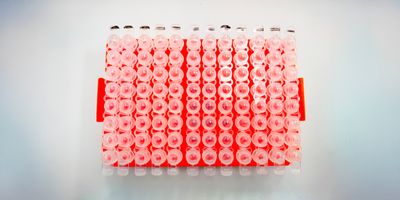 MOBILion’s strategy is to integrate its HRIM technology across the mass spectrometry ecosystem, extending beyond proteomics into metabolomics, lipidomics, exposomics, and other high-value analytical markets.