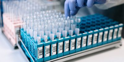  The future of STI diagnostics lies in combining molecular accuracy with operational simplicity.