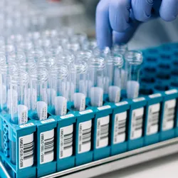The future of STI diagnostics lies in combining molecular accuracy with operational simplicity.