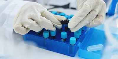 This technology supports minimally invasive cancer detection using a simple blood draw and a fully automated workflow.
