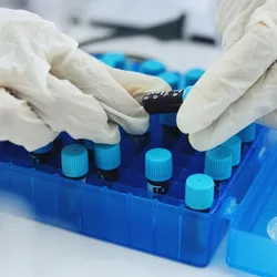 This technology supports minimally invasive cancer detection using a simple blood draw and a fully automated workflow.