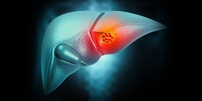 Most cell-free DNA tests aim to detect tumors by sniffing out changes in cell-free DNA that accompany malignant transformation.