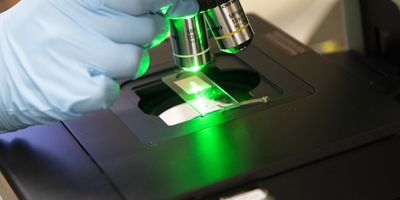 The Lednev lab uses a laser technique called Raman spectroscopy to analyze the chemical composition of materials.