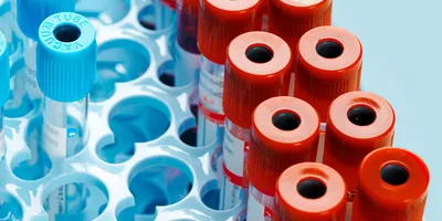 cfDNA continues to gain momentum as a transformative tool in laboratory medicine.