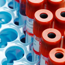 cfDNA continues to gain momentum as a transformative tool in laboratory medicine. 
